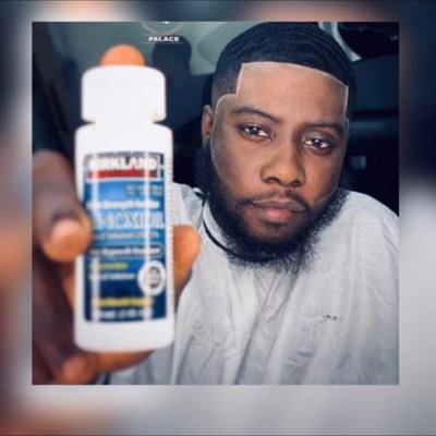 👉🏻We sell original Kirkland minoxidil shipped from US. 👉🏻We also help treat your hair loss and beards growth. 👉🏻Call or WhatsApp us on 09057116036.