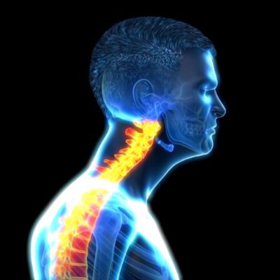 Neck Posture Active Alerts app for iOS
Available Now!