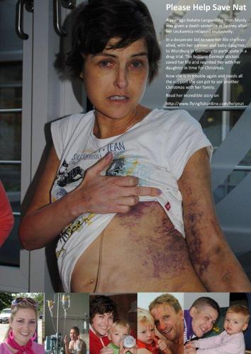 SaveNatCampaign's profile picture. we're appealing for donations for LIFESAVING TREATMENT for Natalie Langworthy, a young mother  who is seriously ill with leukaemia. http://t.co/VXI9gTgQoU