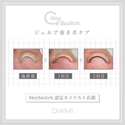 プライベートネイルサロン
✮ヘイスイッチ巻き爪ケア
✮パラジェル登録サロン
✮パラスパ取り扱いサロン
✮手の病院サロン導入サロン
✮手の専門sosoサロン
✮ルビケイト導入サロン
✮マオジェル導入サロン