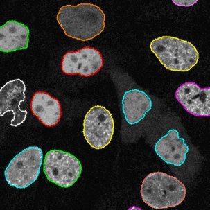 ambiaschool's profile picture. The summer school is focused on the advanced methods of biomedical image analysis with emphasis on bio(microscopy) image analysis. web: https://t.co/gElWIWBIyO