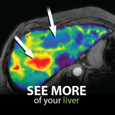 Lovers of imaging science. Developers of MR Elastography. Believers in patient-centered imaging. A @MayoClinic company #NAFLD #NASH #HCV