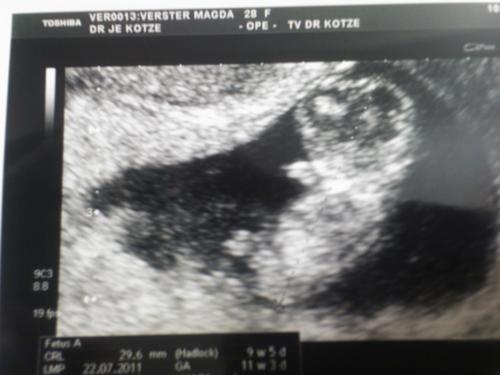 MagdaHeiberg's profile picture. I'm a doctor with a passion for kids. I want to make a difference and be a voice for the kids.