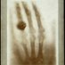 Radiologist_reloaded (@dr_rgupta) Twitter profile photo Radiologist_reloaded (@dr_rgupta) Twitter profile photo