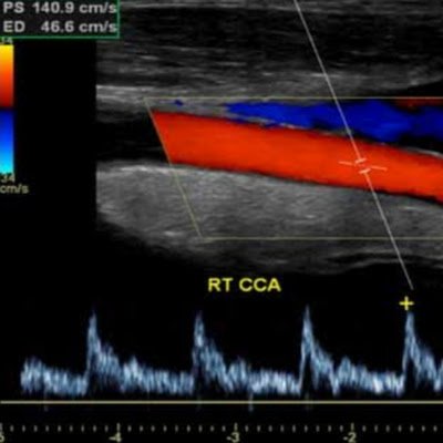 Cirujano de Tórax y Cardiovascular, en Hospital Base III Puno - Perú.