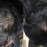 キツネ＠科学が認めた薄毛／抜け毛の最終兵器AGA治療薬などを紹介 (@agaf0x91) 's Twitter Profile Photo