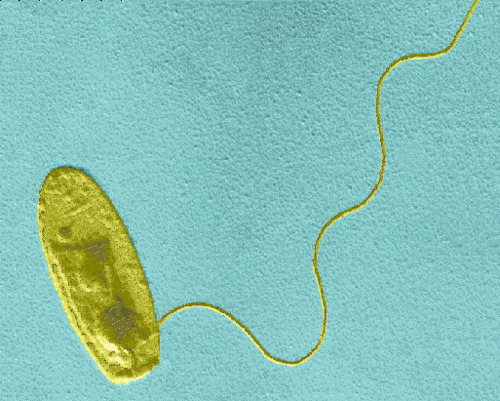 Hi! I’m Larissa!  I am a Legionella Pneumophila Bacterial Cell. I am a gram negative bacterium