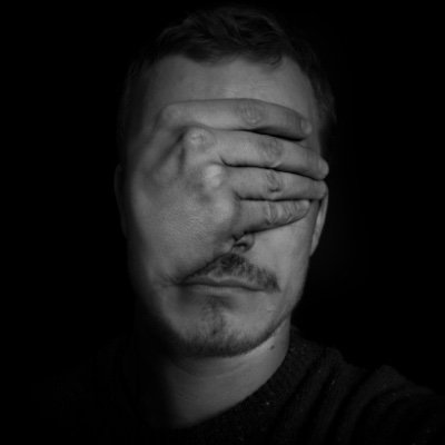 afterlasik's profile picture. Недовольные пациенты, опыт пострадавших, реальные отзывы спустя много лет, проблемы и последствия после лазерной коррекции зрения.