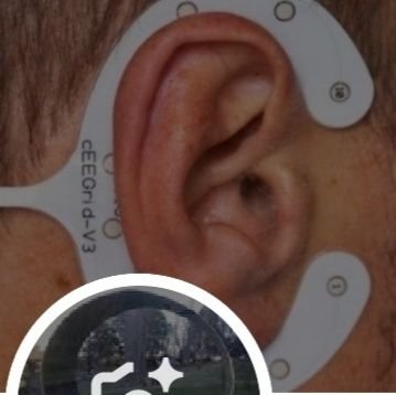 Ai BCi, Brain Comp Brainlink, CHATbot, AVE,
TENS, Transcranial Magnetic Stim, TCDC, EEG, Infra/Ultrasound, Lucid dream, DOS,
Havana Syndr,
Hackers, Cyber Abuse