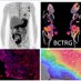 Breast Cancer Translational Research Group (@bctrg_lab) Twitter profile photo Breast Cancer Translational Research Group (@bctrg_lab) Twitter profile photo