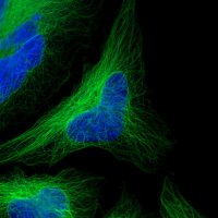 Aberdeen Microscopy (@abdn_micro) 's Twitter Profile Photo Aberdeen Microscopy (@abdn_micro) 's Twitter Profile Photo