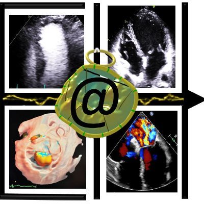 Harefield Echocardiography