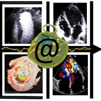 Harefield Echocardiography (@echo_harefield) 's Twitter Profile Photo