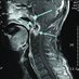 CranioCervicalInstability (@craniounstable) Twitter profile photo CranioCervicalInstability (@craniounstable) Twitter profile photo