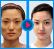 로미안성형외과 better face better life! 
romian plastic surgery clinic in korea, Seoul
http://t.co/kp3SCB9ixh 강남역11번출구