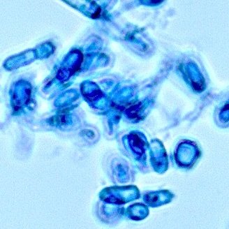 Understanding Valley fever in our canine companions and understanding basic biology and Coccidioides in the environment can help understand human disease