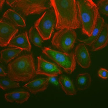 Understanding Cell-ECM interactions in wound healing, fibrosis & cancer to improve the lives of veterinary and human patients. Official account of the Volk Lab.