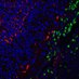 Marbrey Lab (@marbreylab) Twitter profile photo Marbrey Lab (@marbreylab) Twitter profile photo