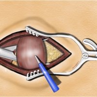 NEUROLOGY INDIA (@indianeurology) 's Twitter Profile
