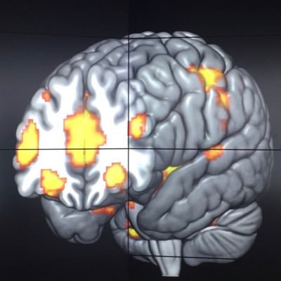 Research at Imperial College London: can gut hormones help eating/addictive behaviours in people who are overweight or have alcohol or drug dependence.