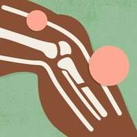 Rheumatology in Low and Middle Income Countries (@rheum_lmic) 's Twitter Profile