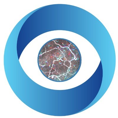 FrontTear Research Centre @UniMelb, jointly led by A/Prof @DrLauraDownie and Dr @Holly_Chinnery, at the forefront of ocular surface research.  https://t.co/TllmZH4s5S