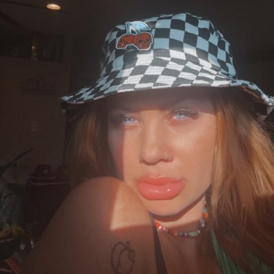 𝔪𝔶 𝔦𝔩𝔩𝔫𝔢𝔰𝔰 𝔦𝔰 𝔠𝔥𝔯𝔬𝔫𝔦𝔠 𝔟𝔲𝔱 𝔪𝔶 𝔱𝔦𝔱𝔰 𝔞𝔯𝔢 𝔦𝔠𝔬𝔫𝔦𝔠 -𝔊𝔥𝔞𝔫𝔡𝔦