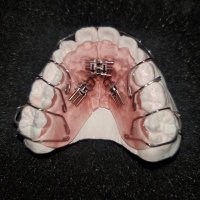 矯正歯科技工NAVI (@shikagikounavi) 's Twitter Profile Photo