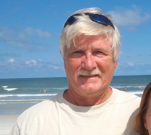 male, 62yrs,  former construction worker