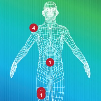 Algorithms that predict the chance of injury and games missed for NFL players | Injury history and statistics data | Part of @draftsharks