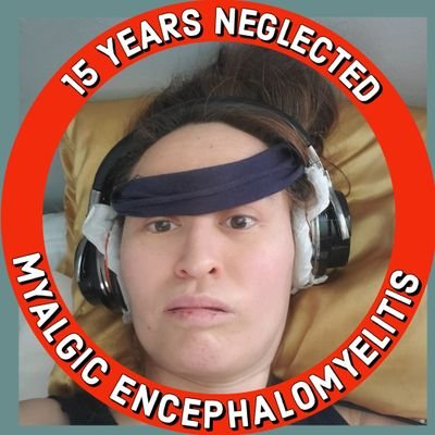 15 years criminally neglected post-viral MEcfs like Long Covid. 🤕 $998 SSI/mo, only after 9 years unable to work! Denied SSDI 3X!