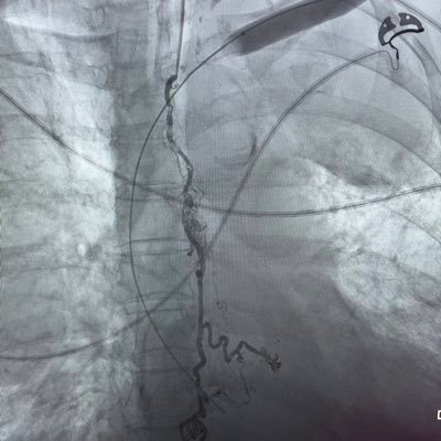 hkmccullough's profile picture. Orange-pilled vascular & interventional radiologist. HODL on.
