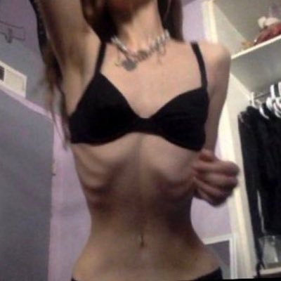 eeribsandbones's profile picture. 21 edtwt 𐐪𐑂 CW: 58.2 kg//128.4 𐐪𐑂 UGW: 48.9kg//108 𐐪𐑂 i ♡ my husband//fatphobic