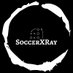 SoccerXRay (@soccerxray) Twitter profile photo SoccerXRay (@soccerxray) Twitter profile photo