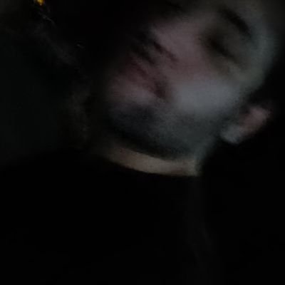 Alejandroga__'s profile picture. tengo alergia