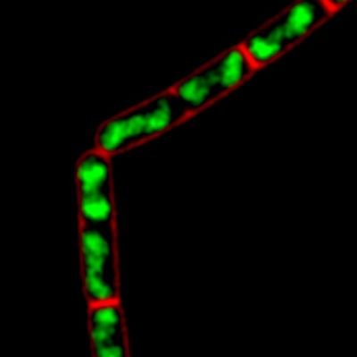 Microbiology Prof at the Centre for Bacterial Cell Biology, Newcastle University. Research focus on antibiotics, AMR and bacterial cell envelopes. 🇫🇮