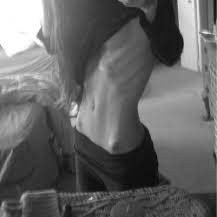 edtwt, forced recovery, diagnosed ana, need new moots, love any and all spo’s, follow to be moots :) cw-41.6kgs ~92lbs 🫶🏽weightless girl🫶🏽