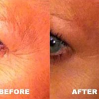 PerfectSkinTeam (@perfectskinteam) 's Twitter Profile