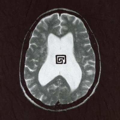 Brainstemlet's profile picture. Podcast about chronic illness and systemic poisoning of our population. Edited/often cohosted by @newvideosurface tweets by intern