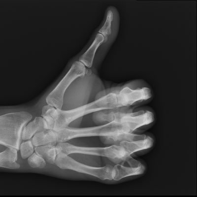 LarsAbrahamsso4's profile picture. Radiologist 🧠🫁🫀💀🏥