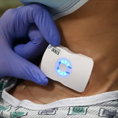 FDA Cleared - Wireless, wearable Doppler ultrasound for push button dynamic assessments and fluid resuscitation.