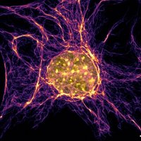 Biophysics of the Cytoskeleton (@schaedellab) 's Twitter Profile Photo Biophysics of the Cytoskeleton (@schaedellab) 's Twitter Profile Photo