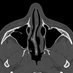 Head and Neck Radiology DASA (@HNRadDASA) Twitter profile photo