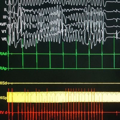 Cardiológo del Hospital Hermanos Ameijeiras