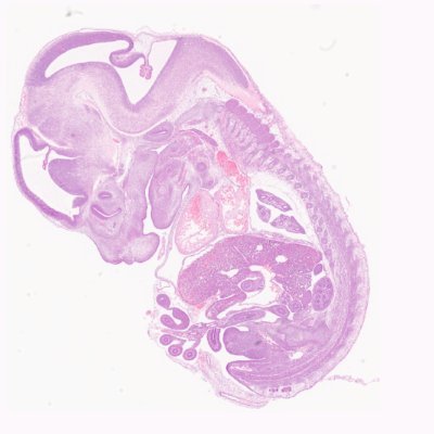 IHC || IF || HE || Pathology consultation

Free TRIAL!