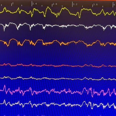 Neuroscientist, Electrophysiologist, Presynaptic, Learning and Memory, Hippocampal Replay