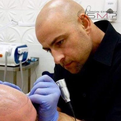 Providing world class scalp micro pigmentation treatments for men and women in London. 7+ years SMP experience. 07398628454 info@simonsymeousmp.co.uk