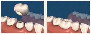 TandartsKiezen's profile picture. Vergelijkingswebsite voor tandzorgtarieven: gratis voor iedereen die op zoek is naar een tandarts.