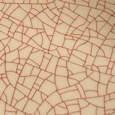 kokorrrrrrrr's profile picture. 1989 2023.1卵管両閉塞発覚 保険採卵 6個凍結 移植①低HCGからの稽留流産②化学流産 ③× ④8w稽留流産 ⑤× 採卵②8個凍結 移植⑥2024.3🧚　マタ垢 @koko20241121