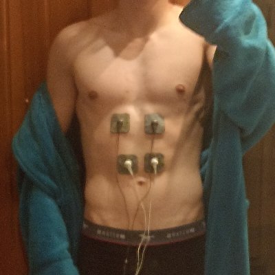 18
swimming
training since 13y o

#electricmuscle
#teenathlete
#electricstim